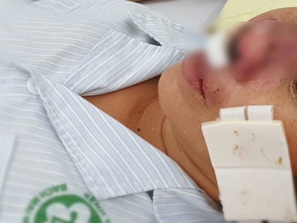ベトナム北部で4人死亡、類鼻疽(るいびそ)が原因か
