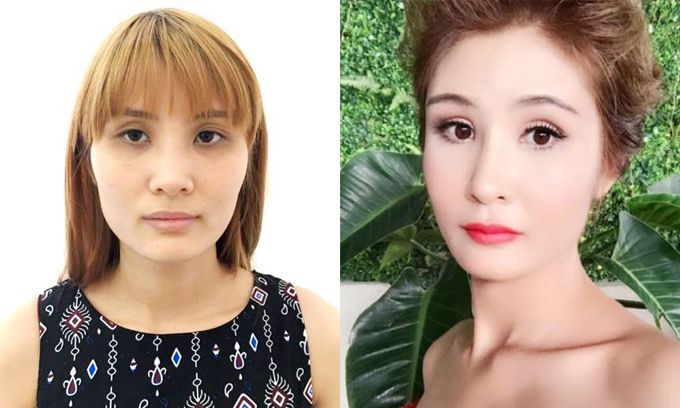より良い愛と運命を求めて整形手術を受けるベトナムの女性