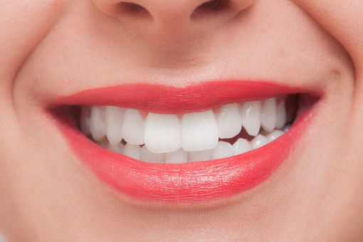 ホーチミンでホワイトニングがしたい!! そんな方にはありが歯科がオススメ