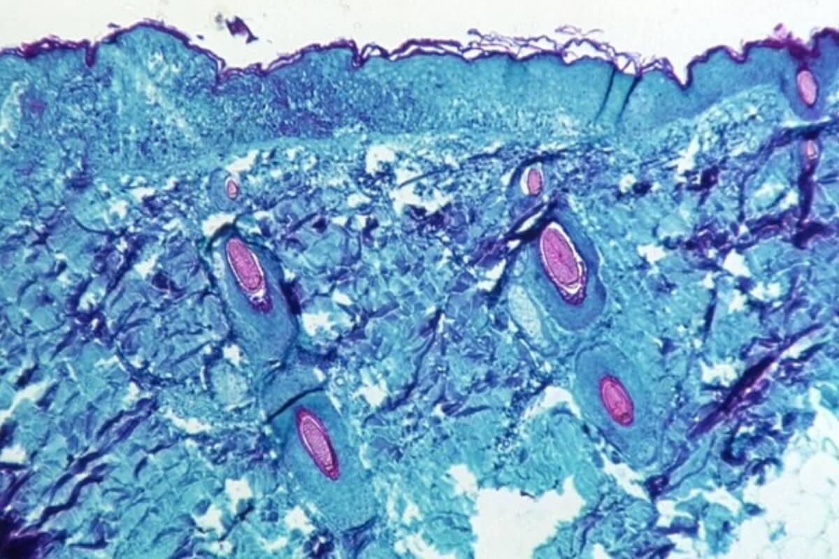 ベトナムがサル痘への監視体制を強化、12カ国での流行で