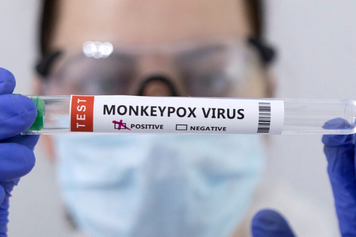 サル痘感染疑いのある人は14日間隔離：ベトナム保健省