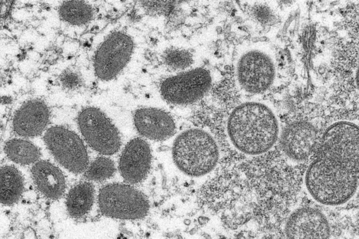 ベトナム、サル痘発生地域からの入国者を21日間監視へ