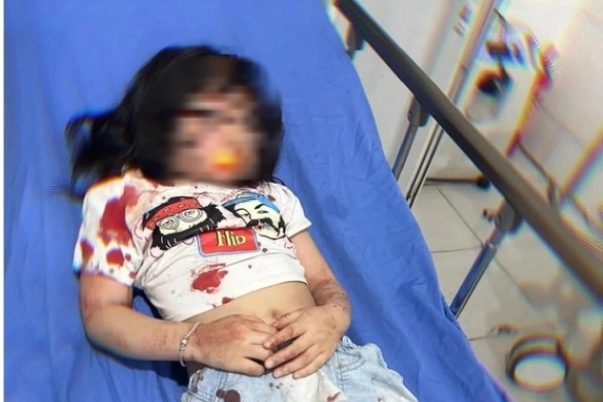 暴れ狂う野良犬、5歳女児が噛まれて重傷