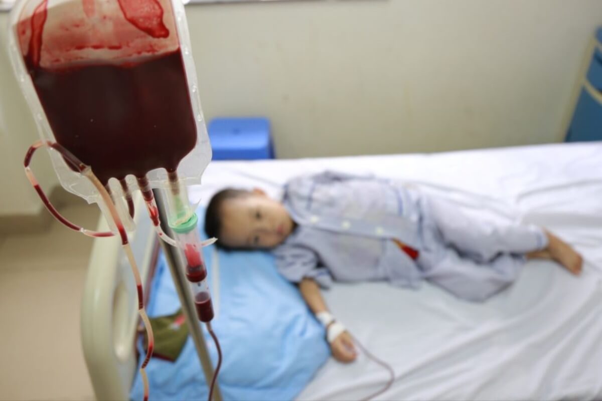 子どもの遺伝性疾患、ベトナムは年間4万人が発症