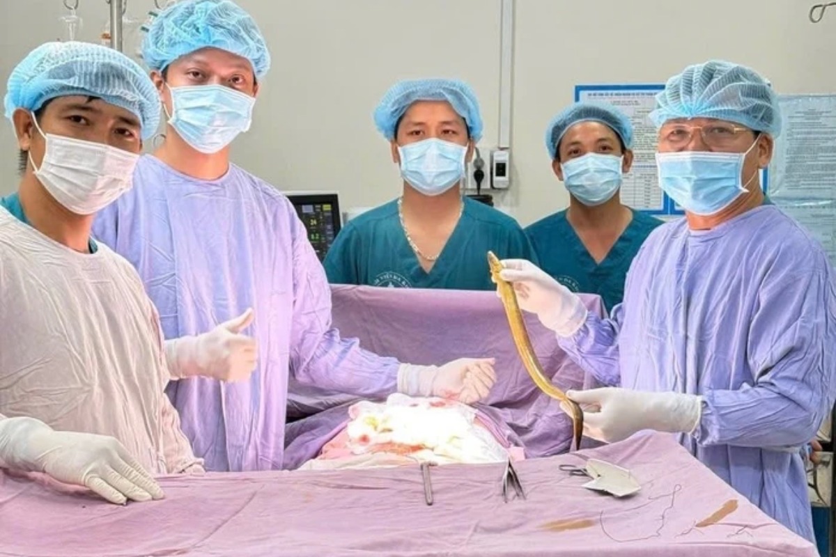 腹腔から50cm超ウナギ摘出、男性が感染性ショックに