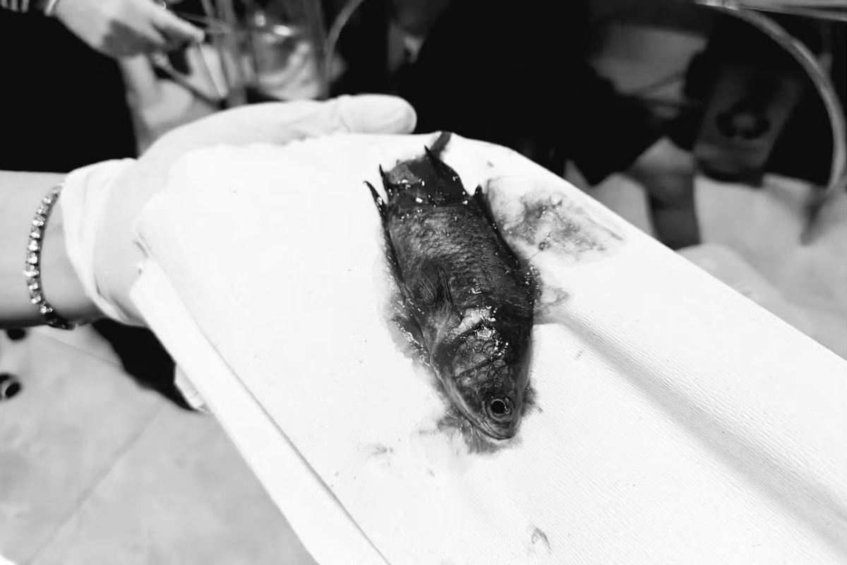 口にくわえた魚が食道へ、生きたまま詰まり救急搬送