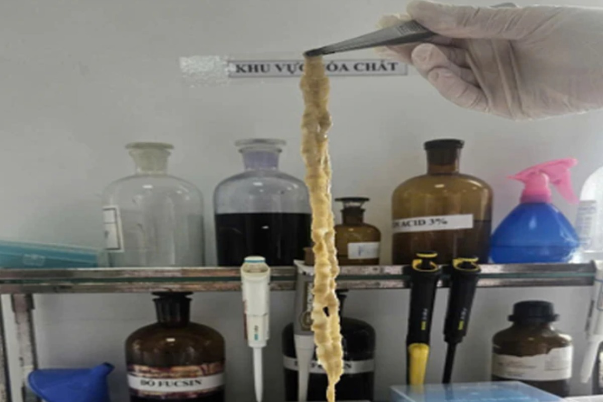 腸内から長さ1.2mのウシ条虫を摘出、加熱不十分な牛肉が感染原因か